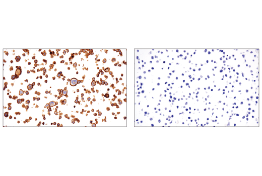 Immunohistochemistry Image 4: CD86 (E2G8P) Rabbit mAb