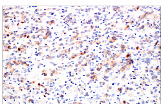 Immunohistochemistry Image 6: CD70 (E3Q1A) Rabbit mAb (BSA and Azide Free)