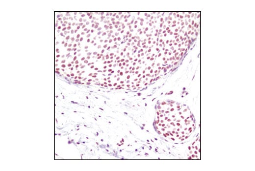 Immunohistochemistry Image 1: Di-Methyl-Histone H3 (Lys4) (C64G9) Rabbit mAb (BSA and Azide Free)