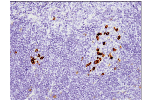 Immunohistochemistry Image 2: PD-1 (Intracellular Domain) (D7D5W) XP<sup>®</sup> Rabbit mAb