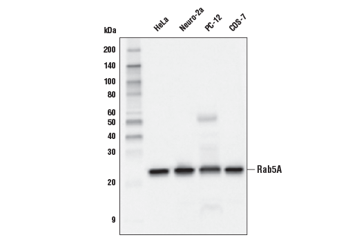 Western Blotting Image 1: Rab5A (E6N8S) Mouse mAb