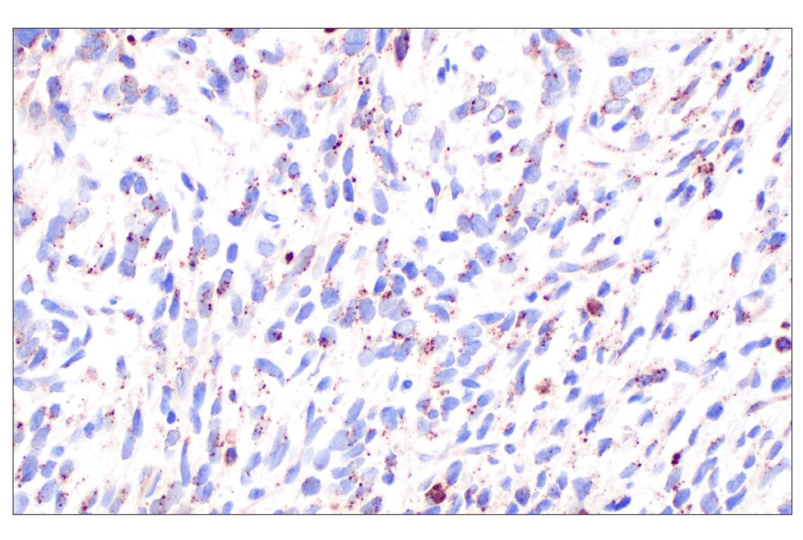 Immunohistochemistry Image 2: Cathepsin A (F8X9E) Rabbit mAb