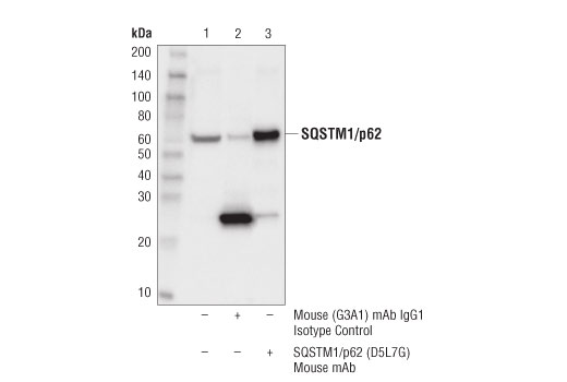 undefined Image 38: Human Reactive Cell Death and Autophagy Antibody Sampler Kit