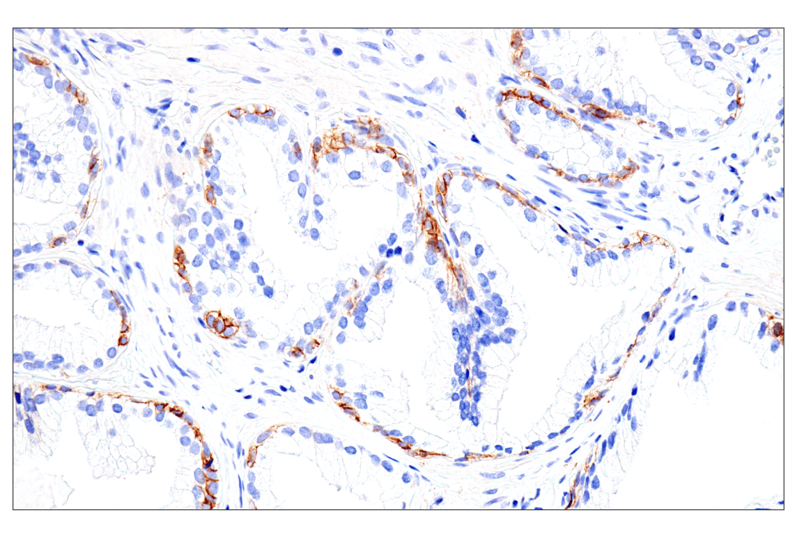 Immunohistochemistry Image 11: Syndecan 1 (E7F7T) Rabbit mAb