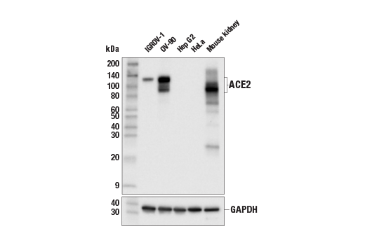 Western Blotting Image 2: ACE2 (E1E1I) Mouse mAb