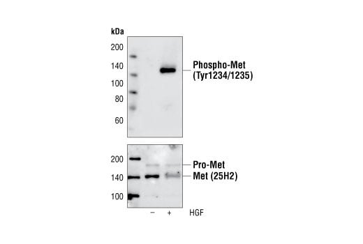 Western Blotting Image 1: Phospho-Met (Tyr1234/1235) (3D7) Rabbit mAb