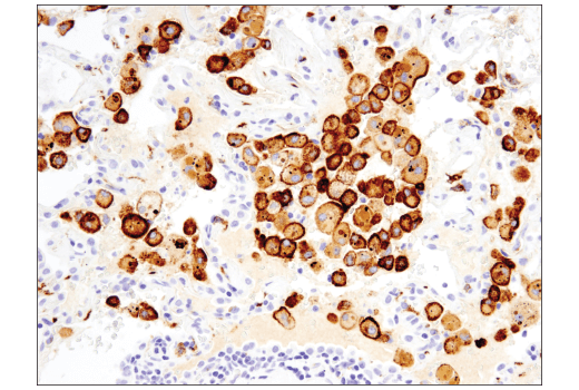 undefined Image 20: Human Reactive M1 vs M2 Macrophage IHC Antibody Sampler Kit