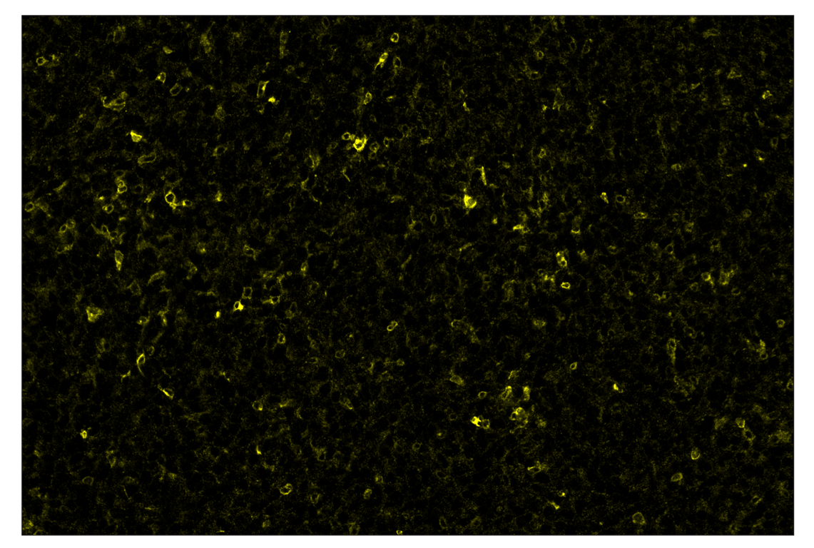 Immunohistochemistry Image 3: CD86 (E5W6H) & CO-0051-750 SignalStar<sup>™</sup> Oligo-Antibody Pair