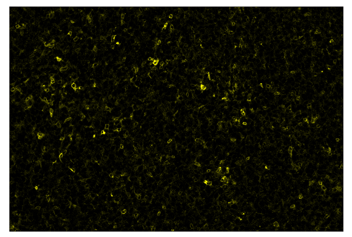 Immunohistochemistry Image 3: CD86 (E5W6H) & CO-0051-647 SignalStar<sup>™</sup> Oligo-Antibody Pair