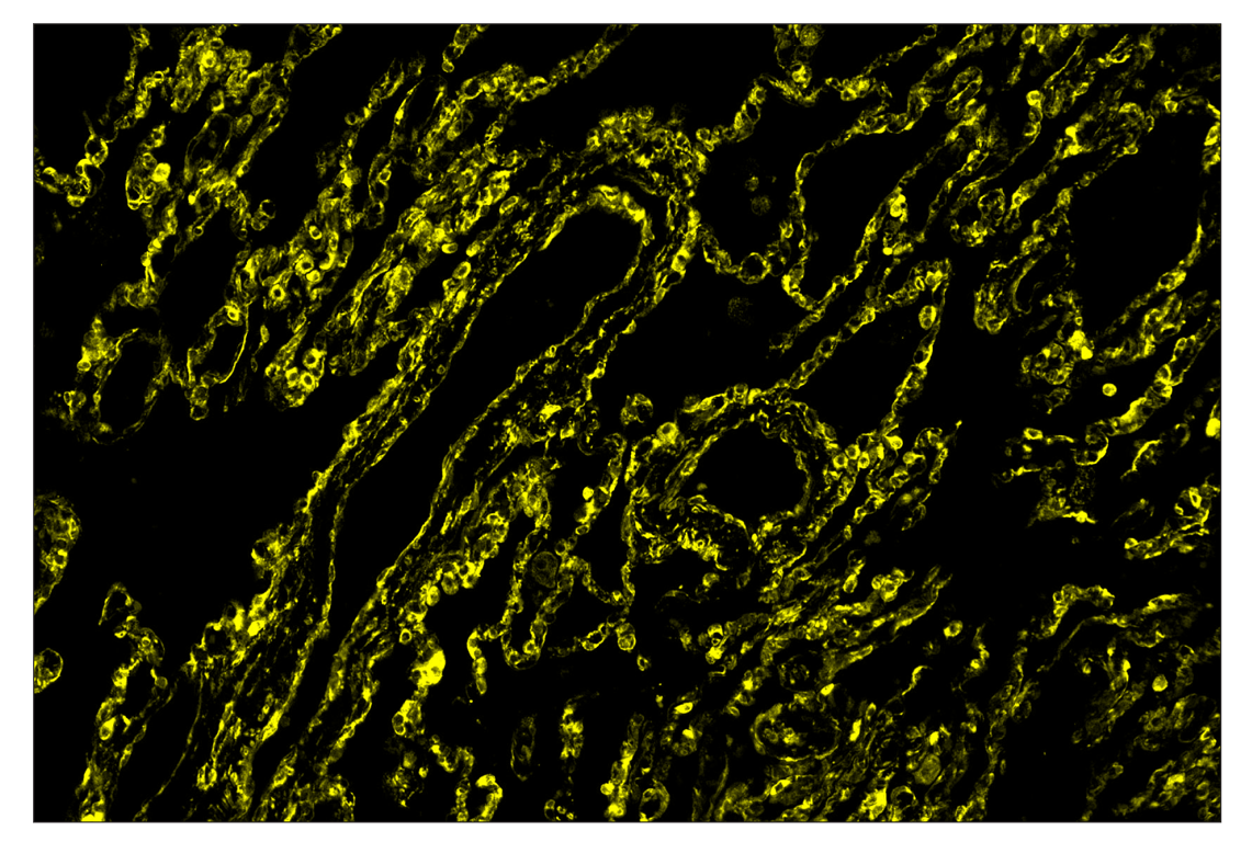 Immunohistochemistry Image 2: Phospho-S6 Ribosomal Protein (Ser235/236) (D57.2.2E) & CO-0107-488 SignalStar<sup>™</sup> Oligo-Antibody Pair
