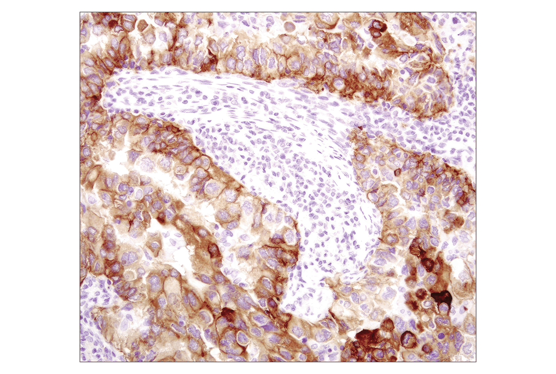 undefined Image 48: Lung Cancer RTK Antibody Sampler Kit