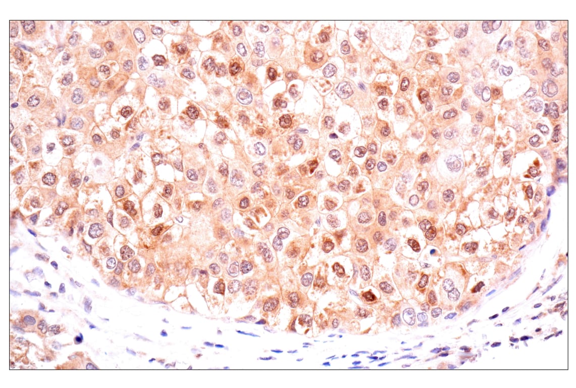 Immunohistochemistry Image 4: ACBP/DBI (E4V8V) XP<sup>®</sup> Rabbit mAb