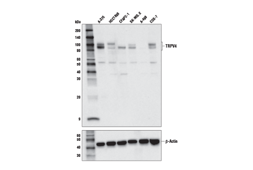 Western Blotting Image 1: TRPV4 Antibody