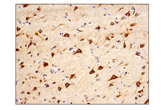 Immunohistochemistry Image 3: APP (E3F3P) Rabbit mAb