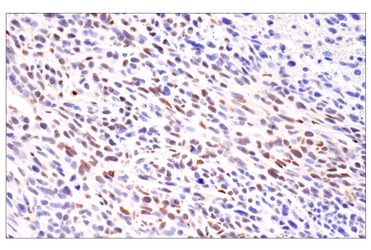Immunohistochemistry Image 6: HIF-1α (E1V6A) Rabbit mAb