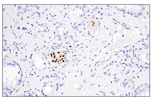 Immunohistochemistry Image 1: Sox10 (E6B6I) XP<sup>®</sup> Rabbit mAb (BSA and Azide Free)
