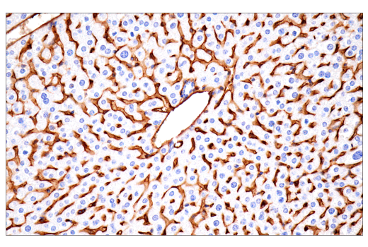 Immunohistochemistry Image 9: CD38 (E9F5A) XP<sup>®</sup> Rabbit mAb