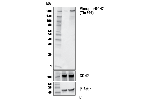 undefined Image 2: PhosphoPlus <sup>®</sup> GCN2 (Thr899) Antibody Duet