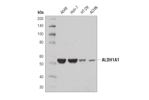 Western Blotting Image 1: ALDH1A1 (D9J7R) XP<sup>®</sup> Rabbit mAb