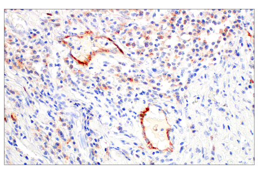 Immunohistochemistry Image 6: LAMP3/CD208 (E6E5U) XP<sup>®</sup> Rabbit mAb (BSA and Azide Free)