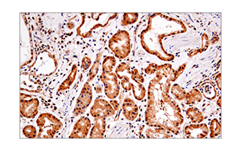 Immunohistochemistry Image 4: RIP (E8S7U) XP<sup>®</sup> Rabbit mAb