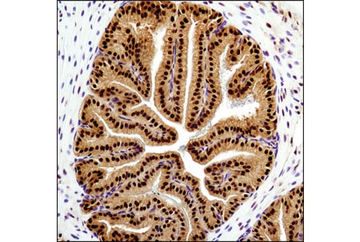 undefined Image 16: Ubiquitin E3 Ligase Complex Antibody Sampler Kit