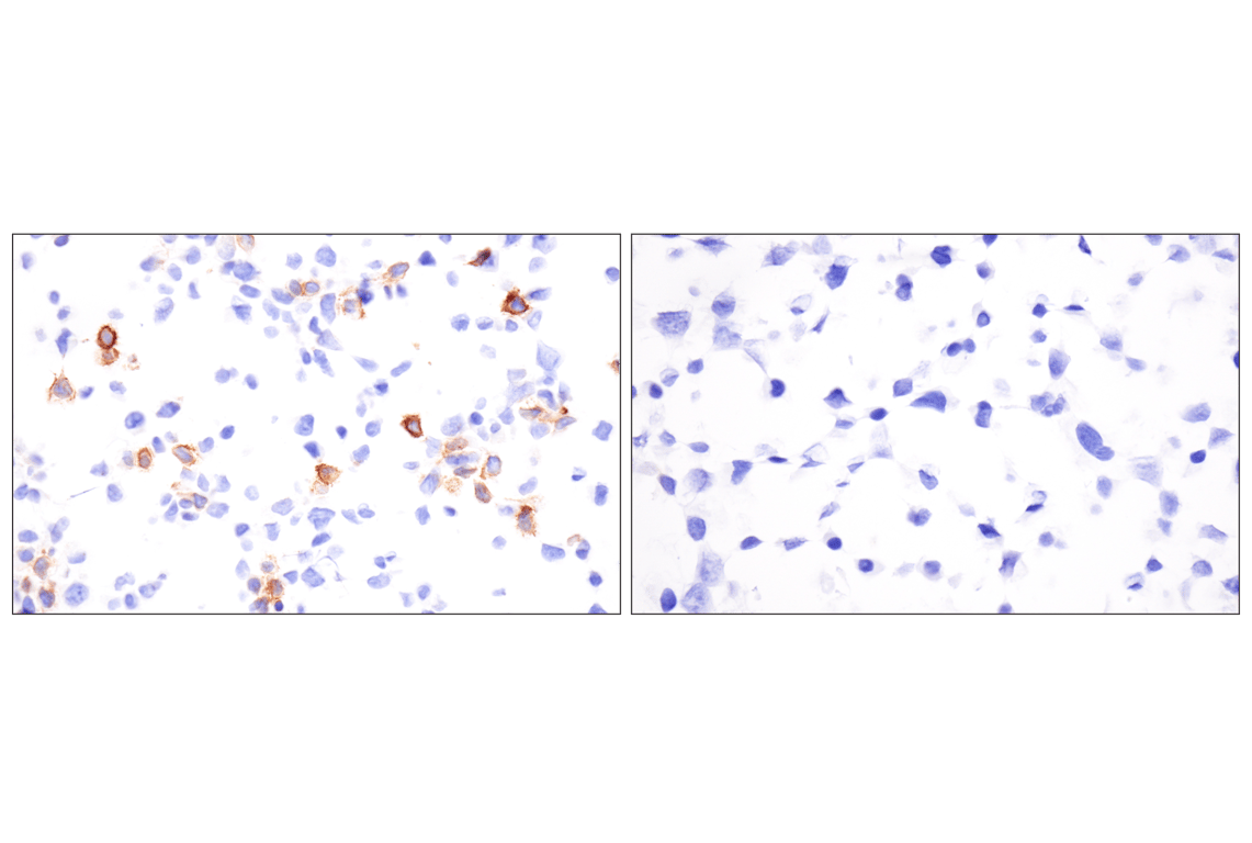Immunohistochemistry Image 12: LRRC15 (E4X8J) Rabbit mAb