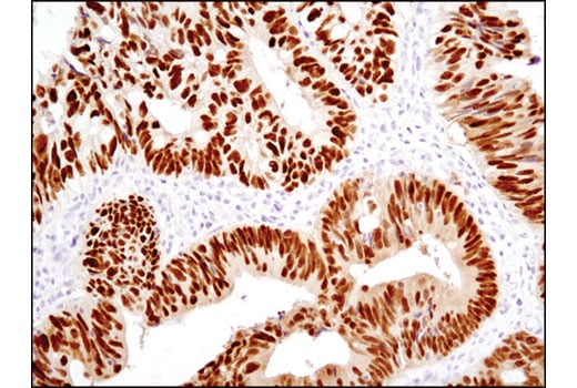 Immunohistochemistry Image 2: CDX2 (D11D10) Rabbit mAb (BSA and Azide Free)