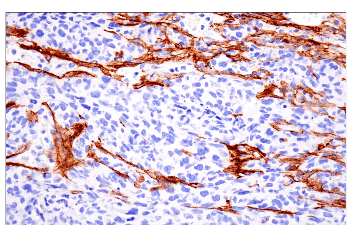 Immunohistochemistry Image 8: LRRC15 (E4X8J) Rabbit mAb