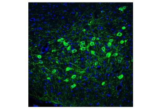 Immunofluorescence Image 1: p75NTR (D4B3) XP<sup>®</sup> Rabbit mAb