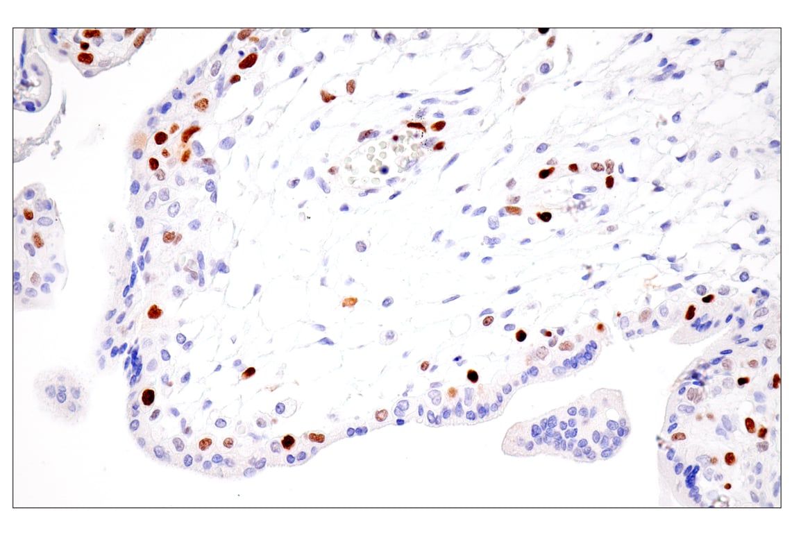 Immunohistochemistry Image 13: UHRF1 (E5W8W) Rabbit mAb