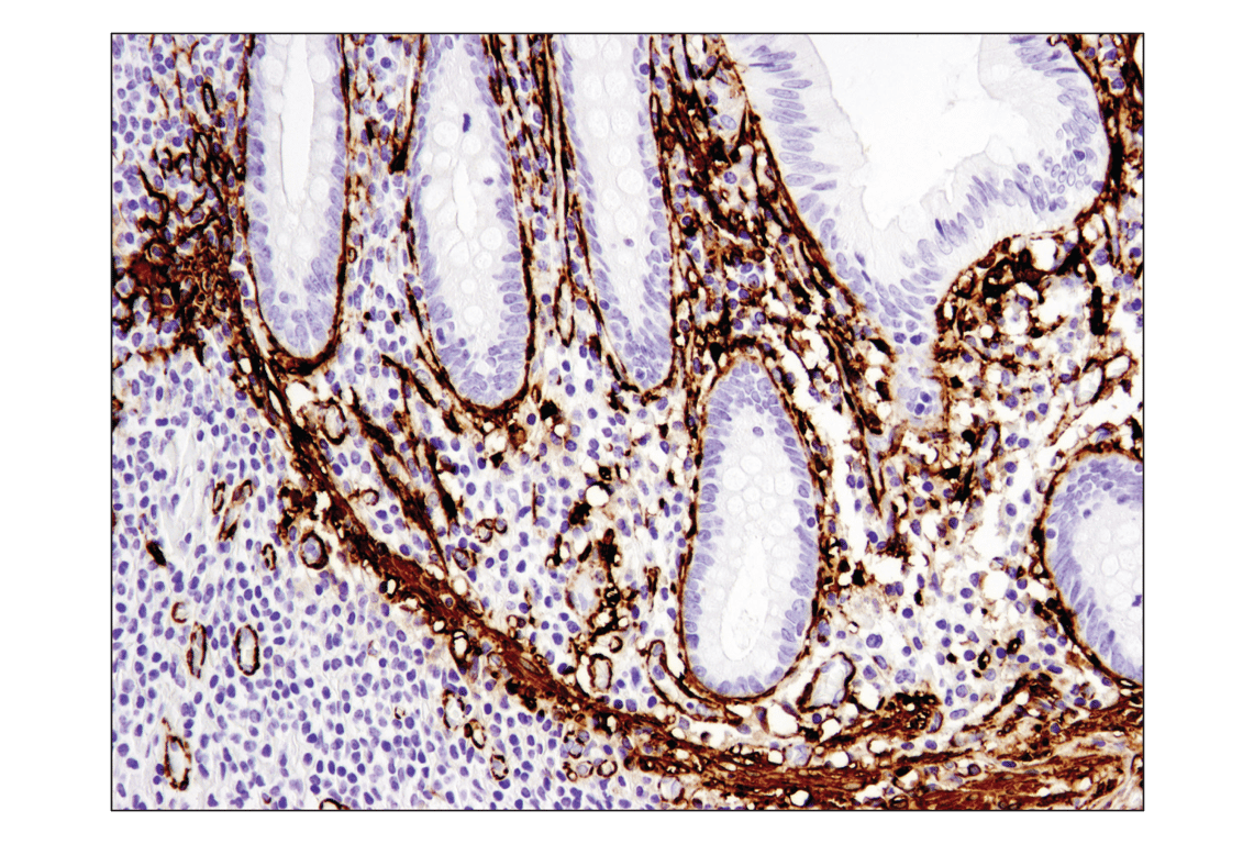 Immunohistochemistry Image 1: α-Smooth Muscle Actin (D4K9N) XP<sup>®</sup> Rabbit mAb (BSA and Azide Free)