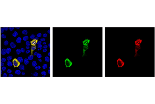 Immunofluorescence Image 1: Cas9 <i>(S. aureus)</i> (6H4) Mouse mAb (Alexa Fluor<sup>®</sup> 488 Conjugate)