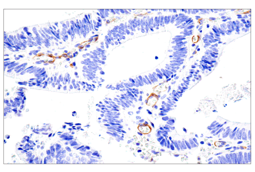 Immunohistochemistry Image 6: NG2/CSPG4 (E3B3G) XP<sup>®</sup> Rabbit mAb (BSA and Azide Free)