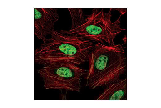 Immunofluorescence Image 1: Di-Methyl-Histone H3 (Lys4) (C64G9) Rabbit mAb