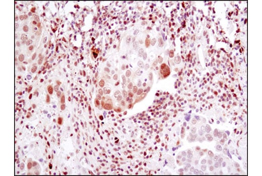 Immunohistochemistry Image 3: Phospho-Stat1 (Ser727) (D3B7) Rabbit mAb