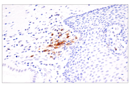 Immunohistochemistry Image 3: TNFRSF13C/BAFF-R (E3C1Q) XP<sup>®</sup> Rabbit mAb (BSA and Azide Free)