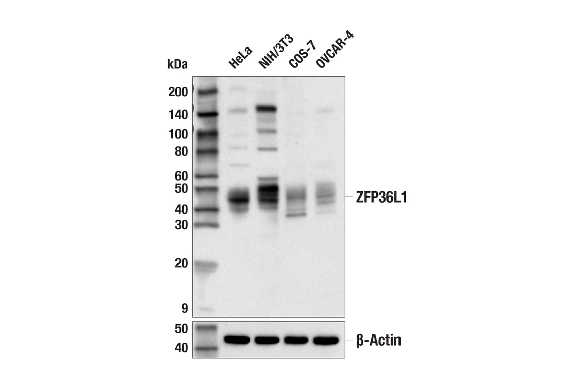 Western Blotting Image 1: ZFP36L1 (E6L6S) Rabbit mAb