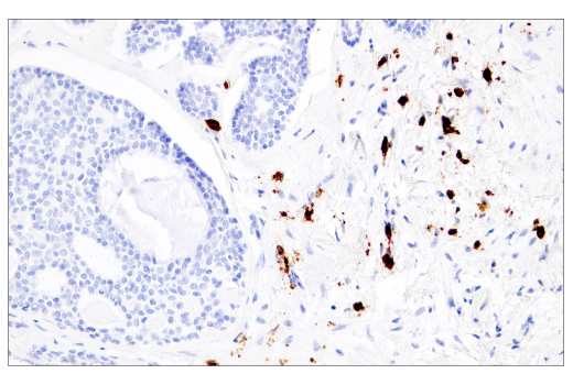 Immunohistochemistry Image 3: CD38 (E7Z8C) XP<sup>®</sup> Rabbit mAb (BSA and Azide Free)