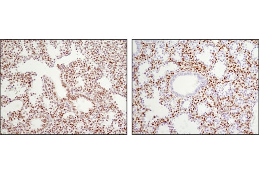 Immunohistochemistry Image 3: RBPSUH (D10A4) XP<sup>®</sup> Rabbit mAb