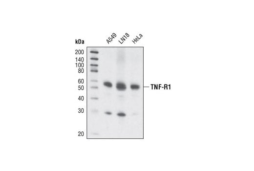 Western Blotting Image 1: TNF-R1 (C25C1) Rabbit mAb