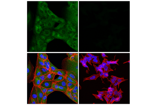 undefined Image 9: Apoptosis/Necroptosis Antibody Sampler Kit II