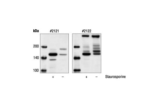 Western Blotting Image 1: Cleaved α-Fodrin (Asp1185) Antibody