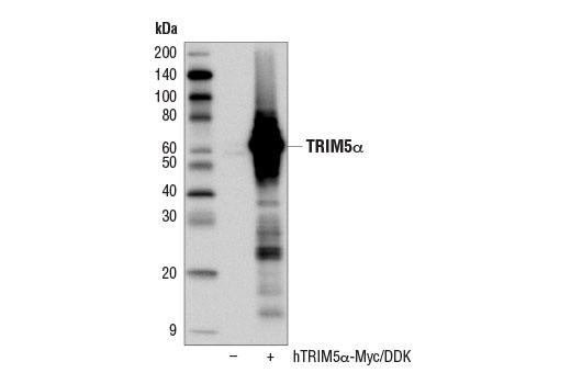 Western Blotting Image 2: TRIM5α (D6Z8L) Rabbit mAb