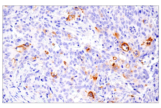 undefined Image 37: SARS-CoV-2 Virus-Host Interaction Antibody Sampler Kit