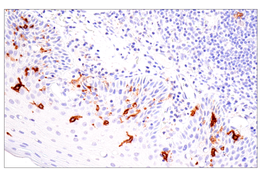 Immunohistochemistry Image 2: CD1A (MTB1) Mouse mAb