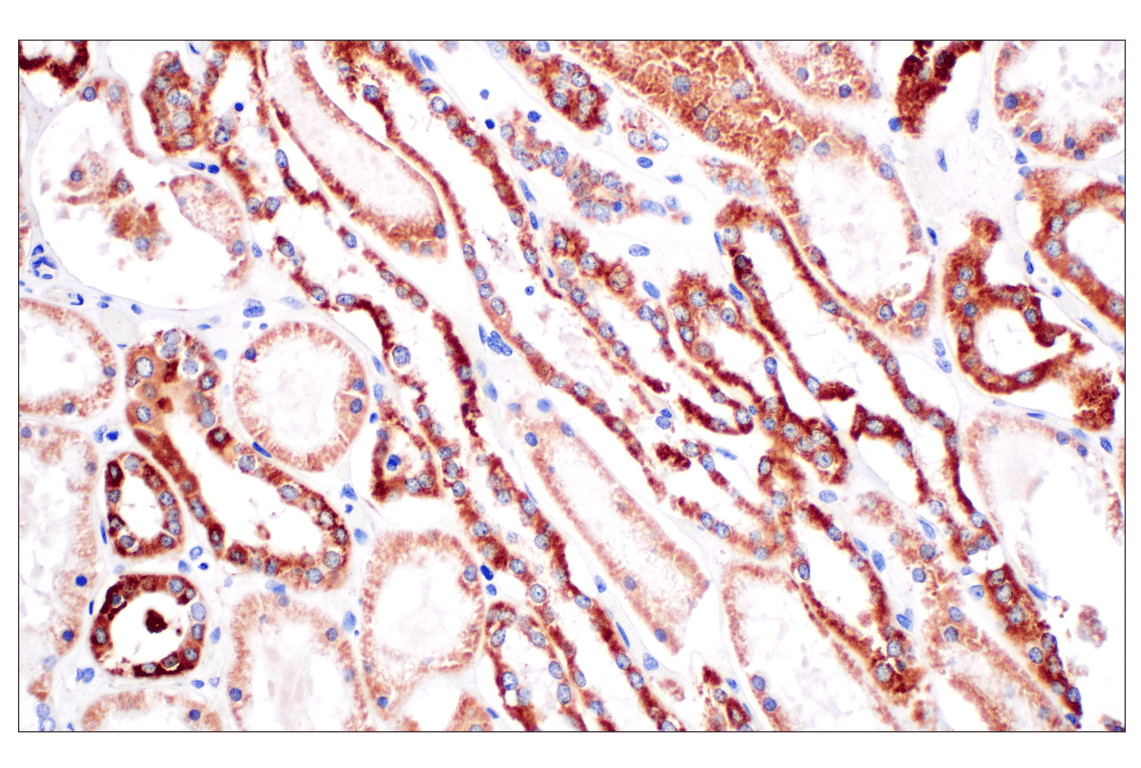 Immunohistochemistry Image 5: CPT1A (E3Y1V) Rabbit mAb