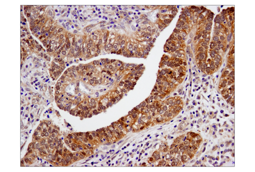 Immunohistochemistry Image 1: SMAD4 (D3R4N) XP<sup>®</sup> Rabbit mAb (BSA and Azide Free)