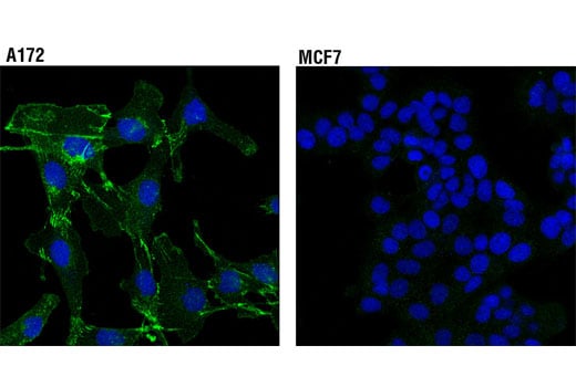 Immunofluorescence Image 1: N-Cadherin (D4R1H) XP<sup>®</sup> Rabbit mAb