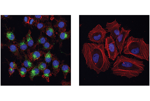 Immunofluorescence Image 1: VISTA (D5L5T) XP<sup>®</sup> Rabbit mAb